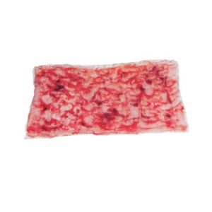 Simulated Individual Burn Roll- 2nd Degree Deep Partial Thickness